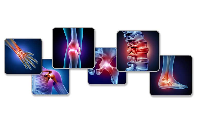 https://www.safetyandhealthmagazine.com/ext/resources/images/news/ergonomics/joint-pain.jpg?1704297646